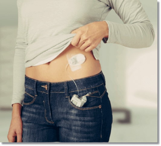 당뇨병 관리에 도움이되는 병아리콩