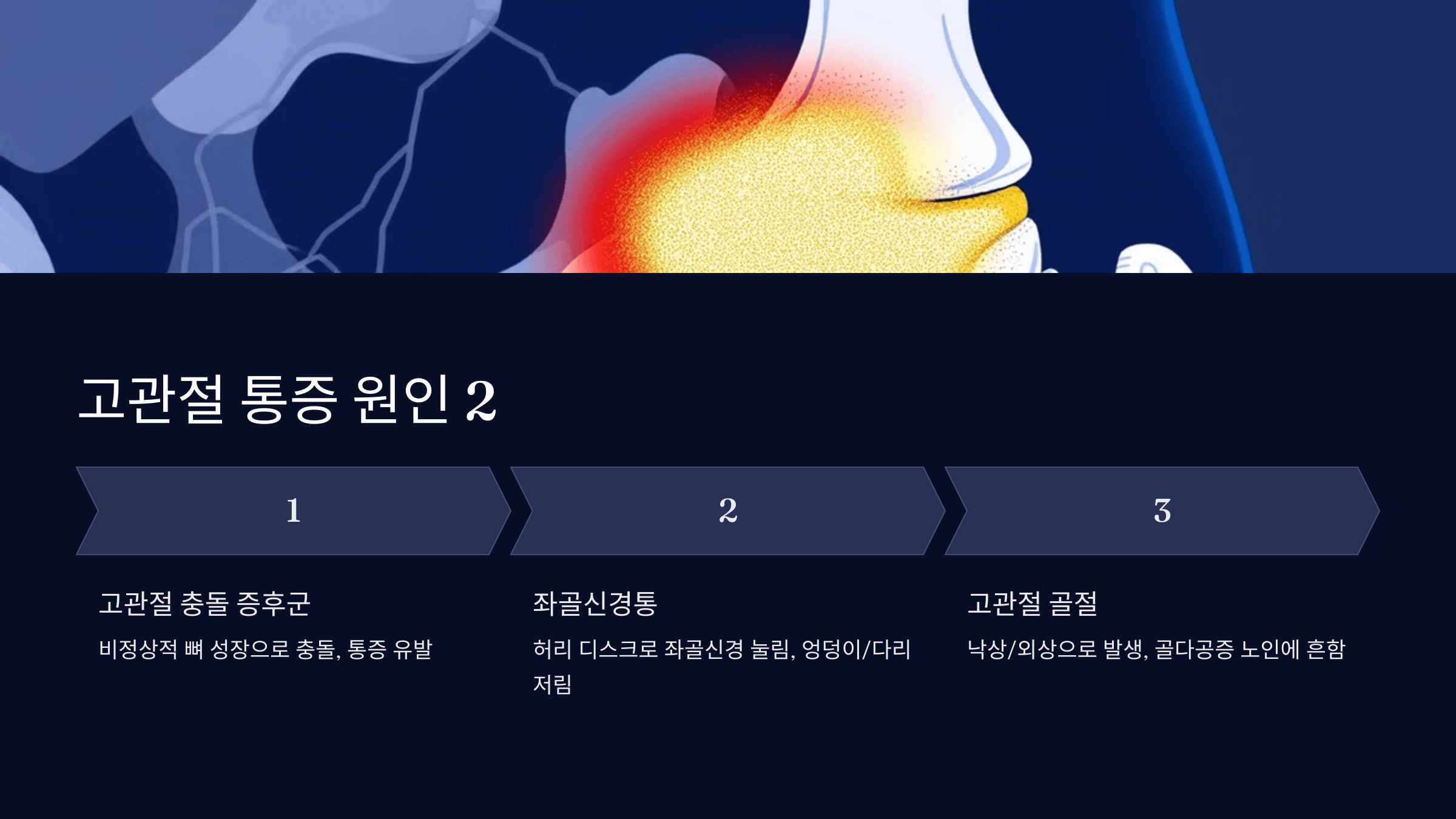 고관절 통증과 관련된 사진입니다.