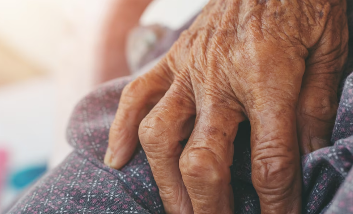 파킨스병의 성별