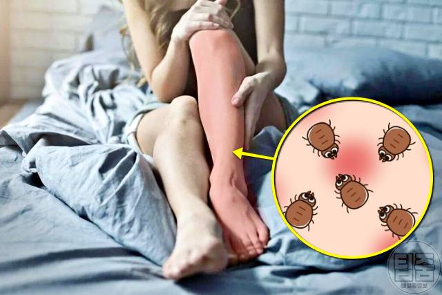 잠이 안 와요 수면장애 원인 잠이 안오는 이유 하지불안증후군