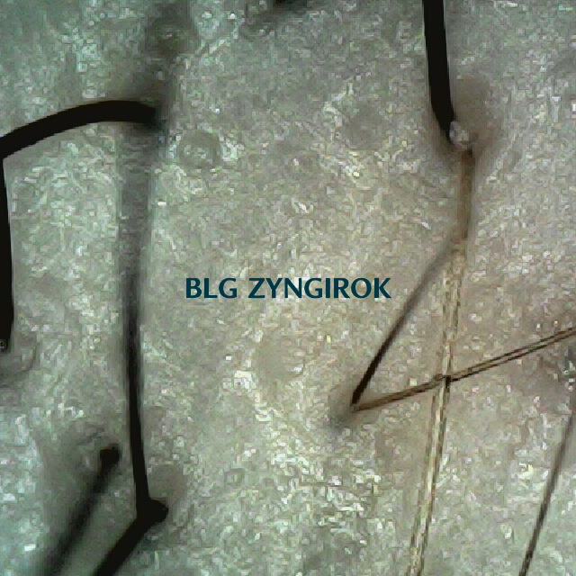 탈모 극복 프로젝트 - 정수리와 이마 사이 두피 모습이다.