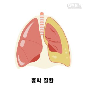 제한성 환기장애