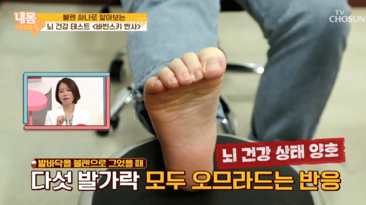 바빈스키 반사-정상