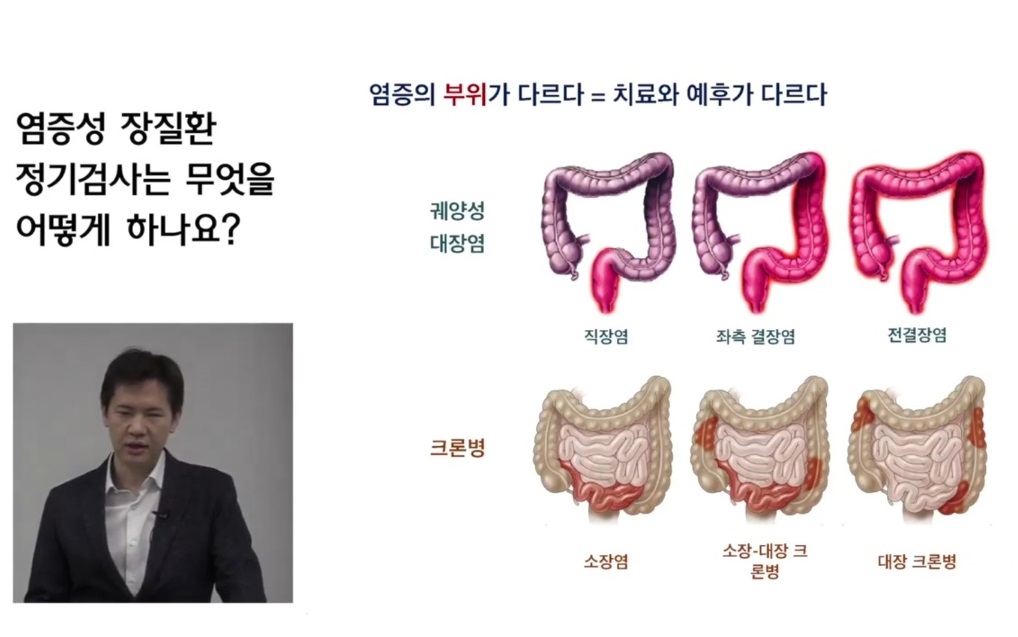 EBS명의-장질환-명의