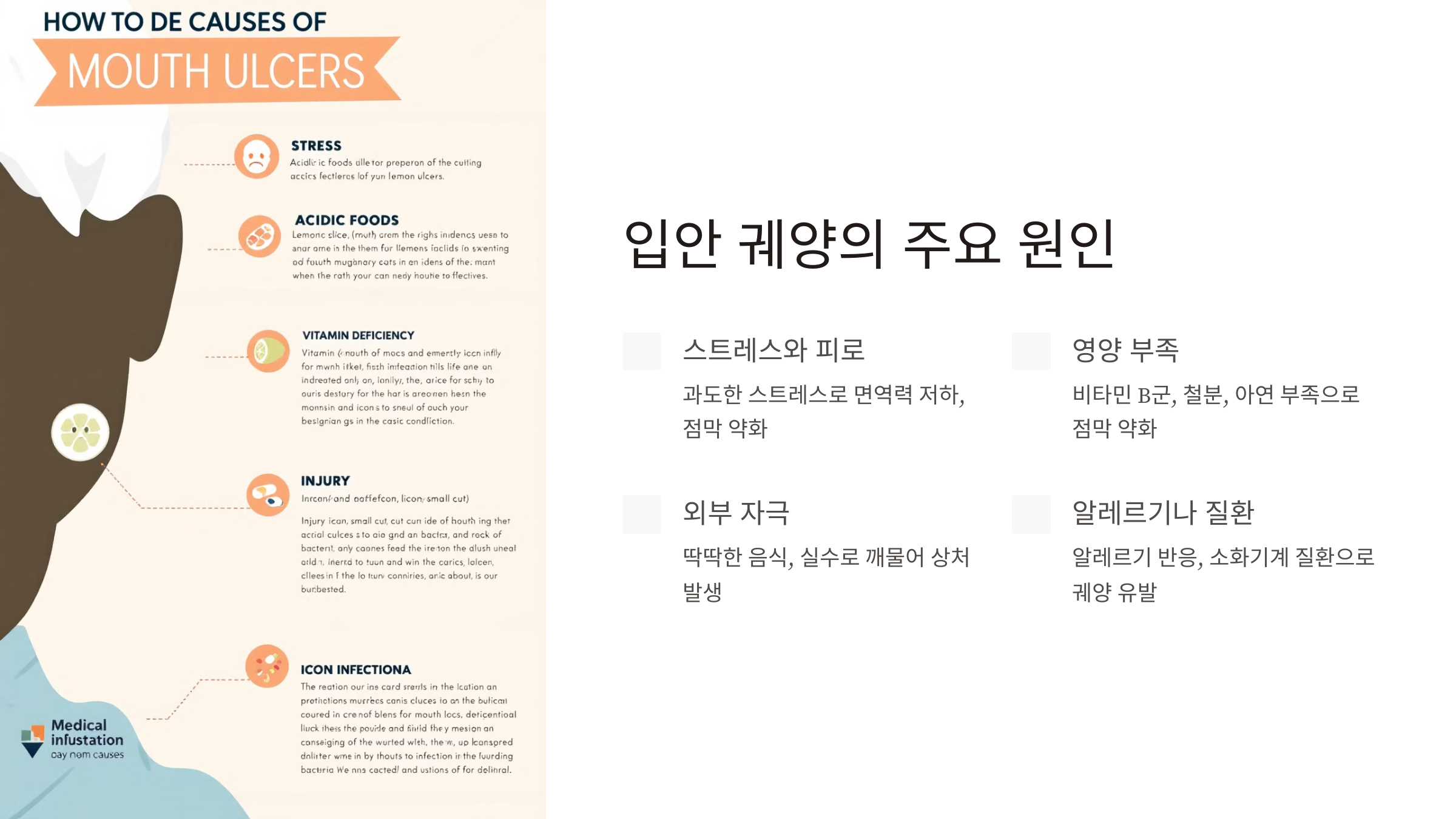 입안이 헐었을때