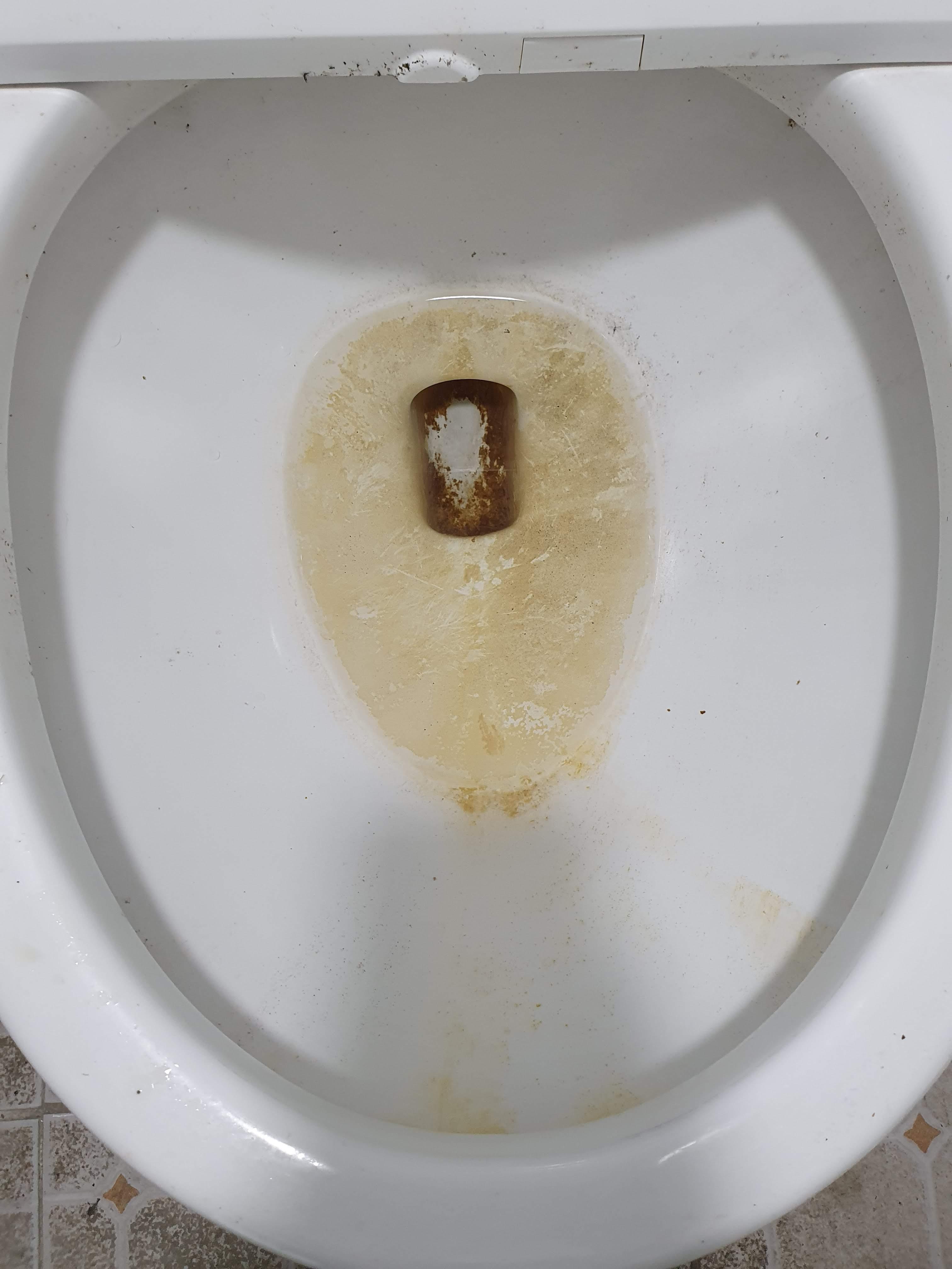 요석 제거