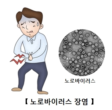 복통이 있는 남자와 노로바이러스 사진