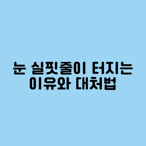 눈 실핏줄이 터지는 이유와 대처법