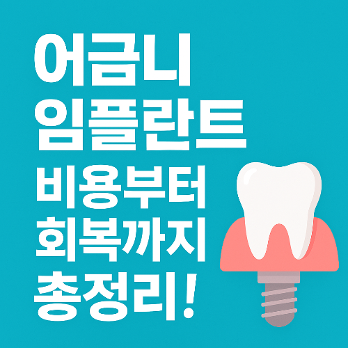 어금니 임플란트, 꼭 해야 할까? 치료 전 알아야 할 모든 것