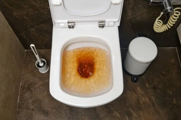 물설사 원인&#44; 이런 증상이 반복된다면? 물설사를 한다고 한가지 질병만 짐작할 수 없잖아요~ 그 원인들을 살펴볼까 합니다. 왜 물설사가 계속 지속되는지와 어떻게 대응할 수 있는 대처법까지 꼼꼼히 확인해 보시기 바랍니다.