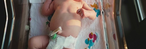 제대가 있는 신생아