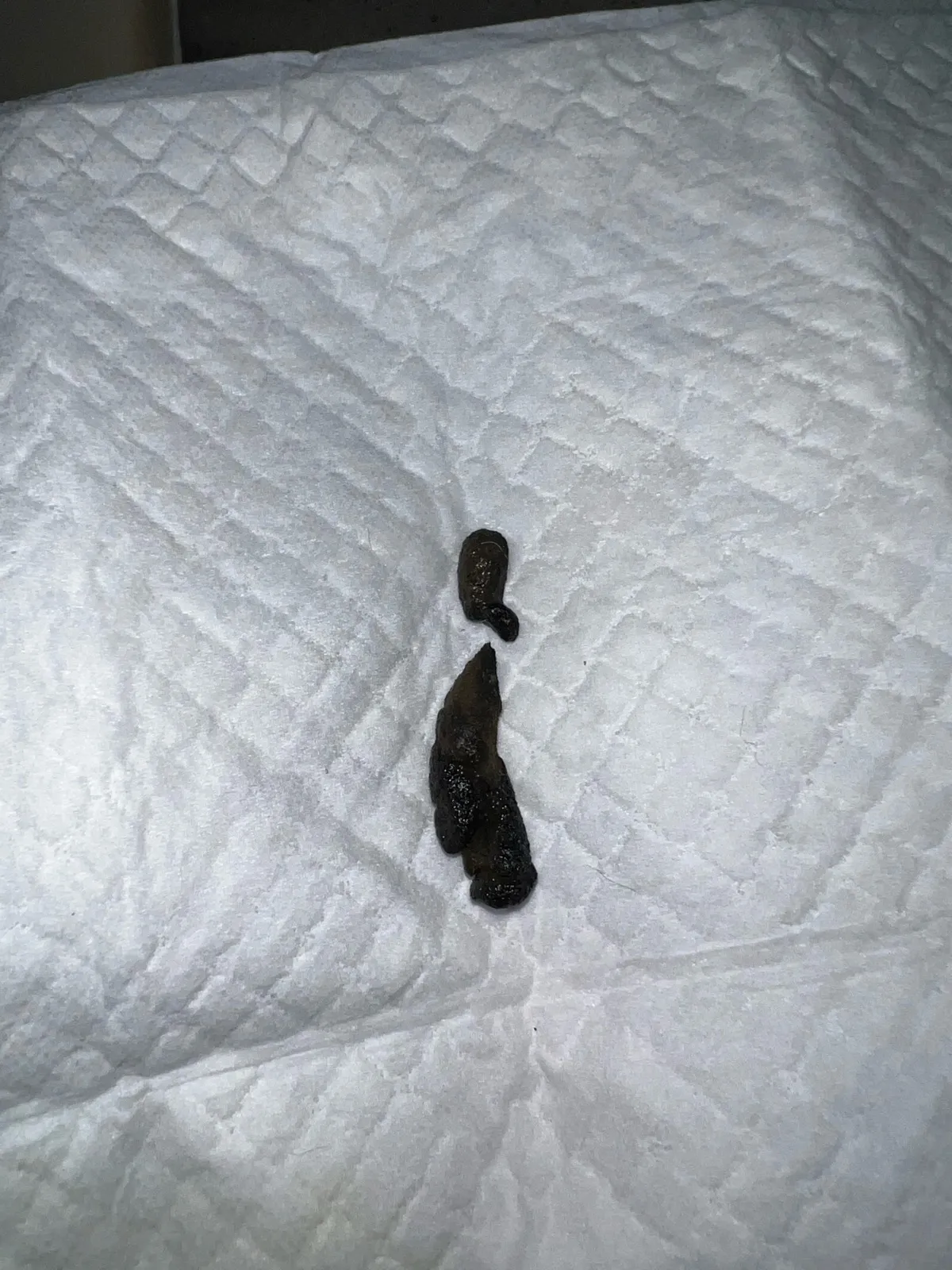 똥이 까만색 검정똥 원인과 질병 가능성_9