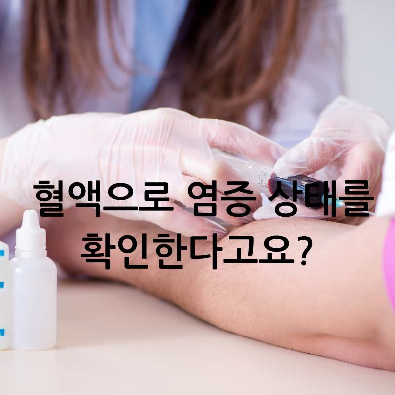 혈액검사 염증수치 검사 비용과 항목 비교