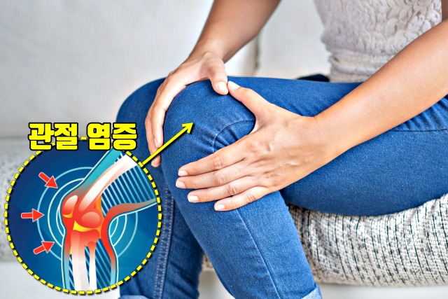 무릎 관절염에 좋은 음식