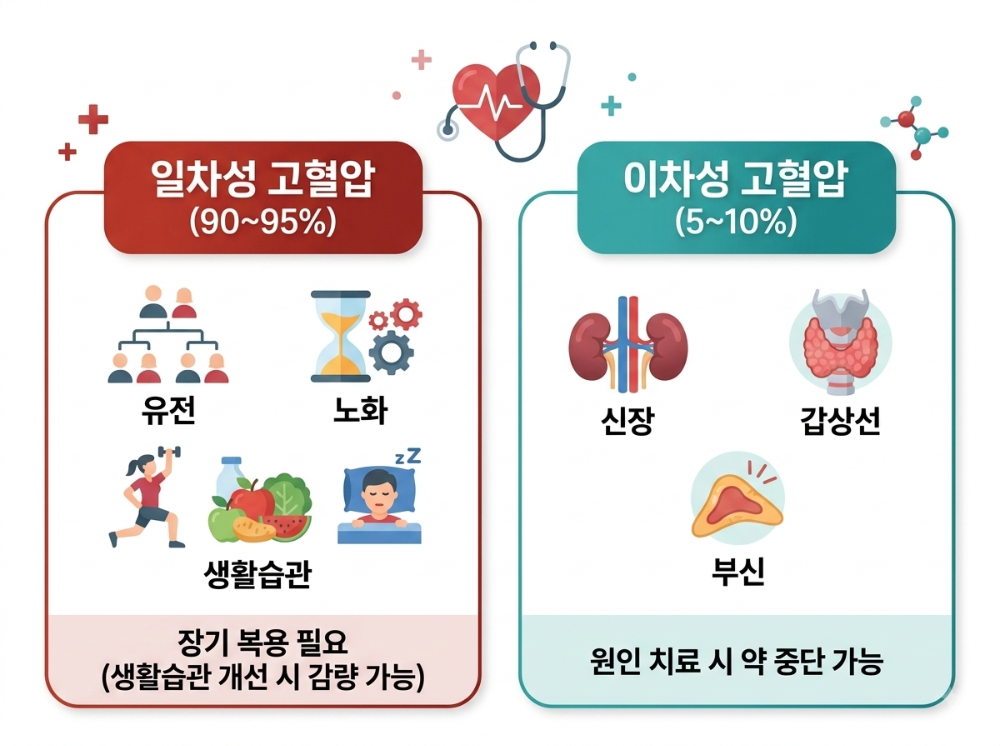 alt="고혈압 종류 일차성과 이차성 고혈압 차이 및 약 복용 기간 비교 인포그래픽"