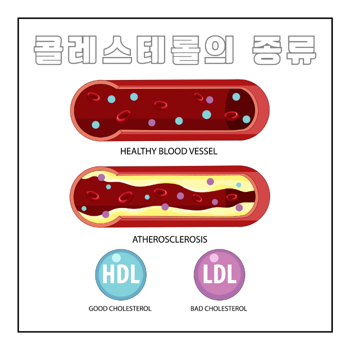 콜레스테롤의 종류