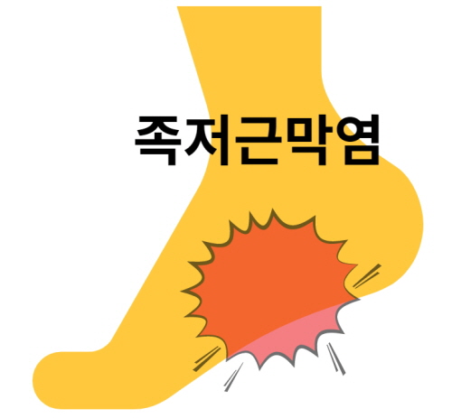 족저근막염 원인