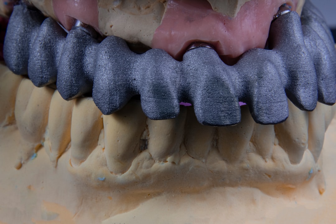 Implant