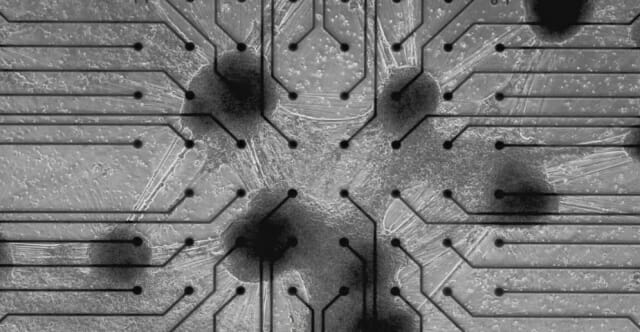 실리콘 칩 위에 살고 있는 실제 인간의 뇌 세포