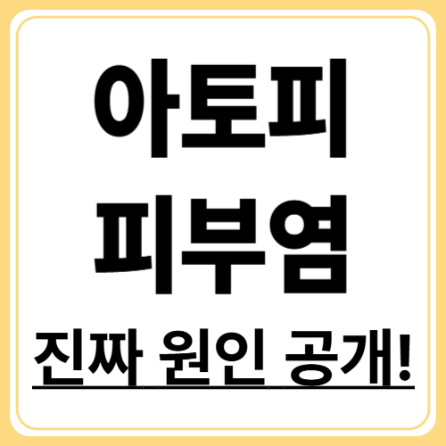 "아토피 피부염의 진짜 원인? 유전·환경·생활습관 총정리