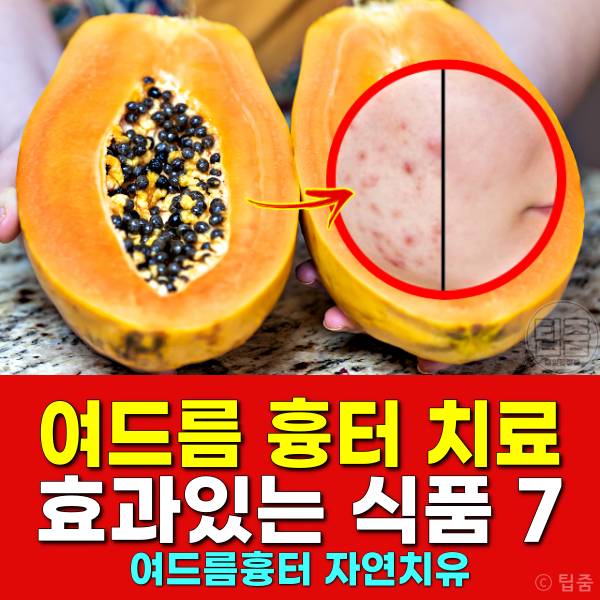 여드름흉터 치료 여드름흉터 없애는법 자연치유