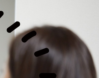 얼굴이 가려운 이유