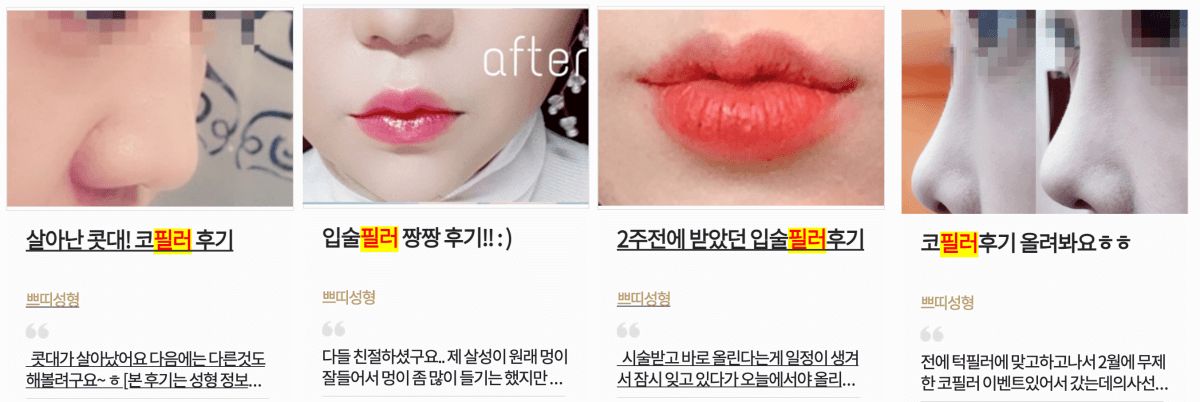 필러후기