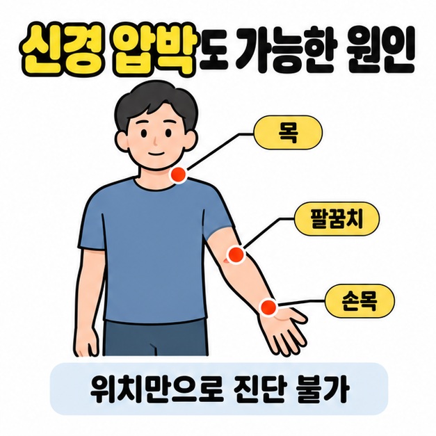 인물의 목과 팔꿈치, 손목에 점과 연결선으로 위치를 표시하고 신경 압박 가능성과 위치만으로 진단할 수 없음을 설명한 이미지