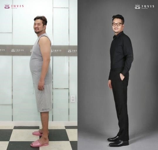 김태우가-쥬비스를-통해-살빠진-전후-사진입니다.