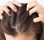 탈모 해결-카페인 함유 샴푸- 효과