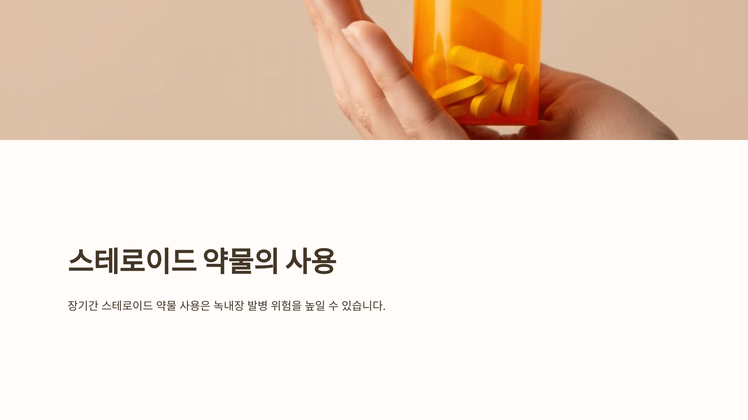 녹내장과 관련된 사진입니다.