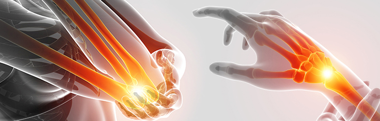 류마티스관절염, 퇴행성관절염 등 관절염 예방관리수칙9