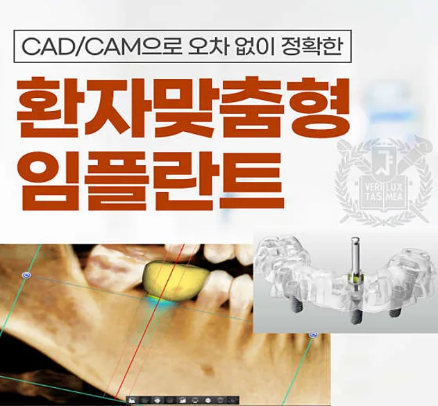 서울에스치과의원 미아사거리