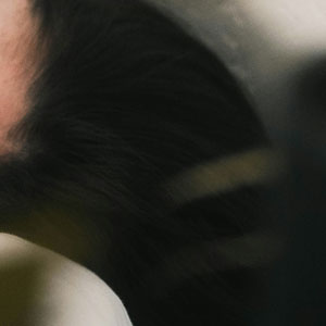 어지럼증과 신경질환 - 보통은 귀나 혈압, 생활 요인이 원인