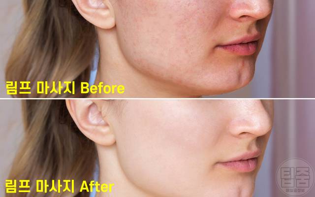 얼굴색 밝아지는법 림프마사지 효과