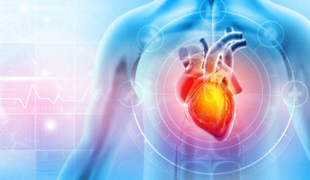 심근경색-초기증상