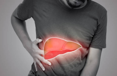 지방간 증상, 없애는 방법, 원인 총정리 (2024ver)