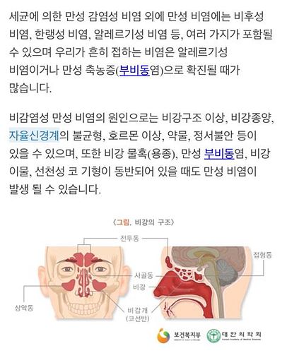 비염 치료