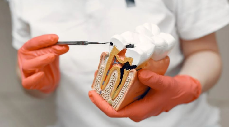 虫歯(むしば, mushiba)