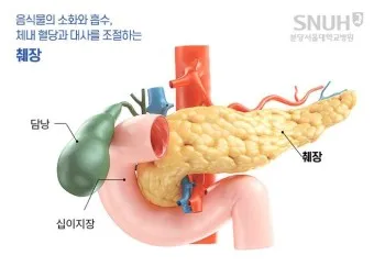 췌장암 초기 증상 췌장암 등통증 위치 검사_12