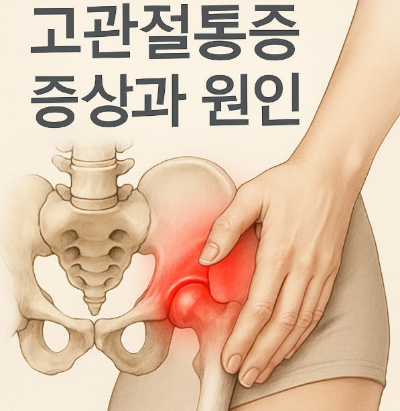 고관절통증 증상과 원인