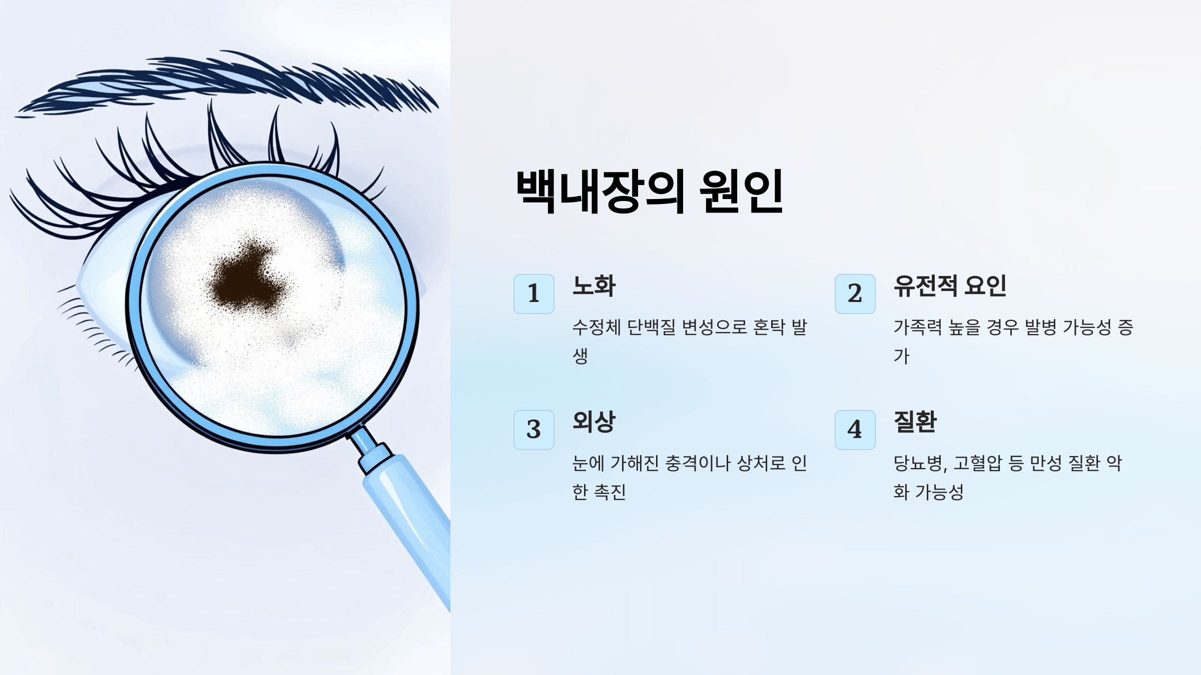 백내장과 관련된 사진입니다.