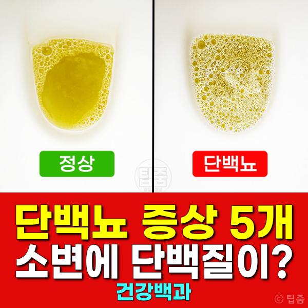 단백뇨 증상 소변거품