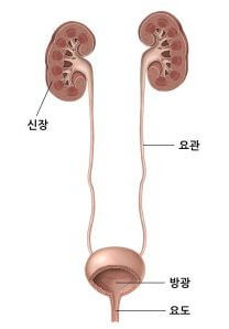 방광염이란