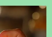 땀띠 원인과 증상 &amp; 치료