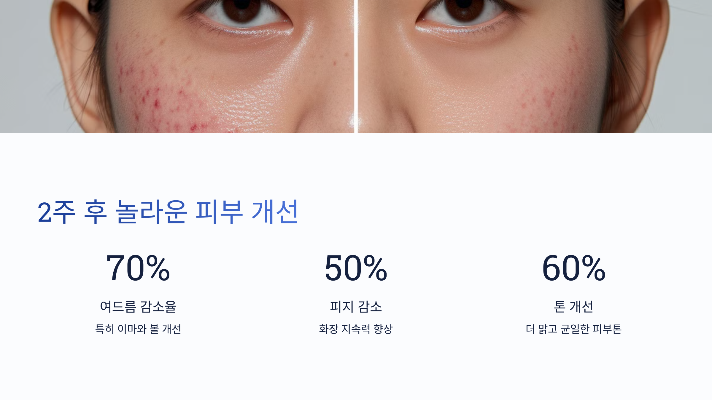 클리어틴으로 좁쌀 여드름 극복기