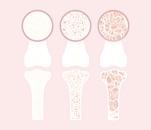 콘드로이친 효능 부작용