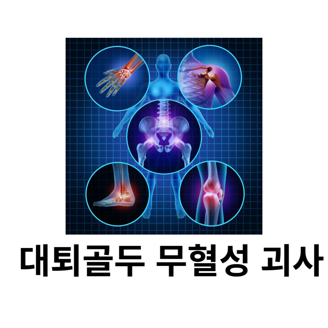 대퇴골두 무혈성 괴사와 관련된 사진입니다.