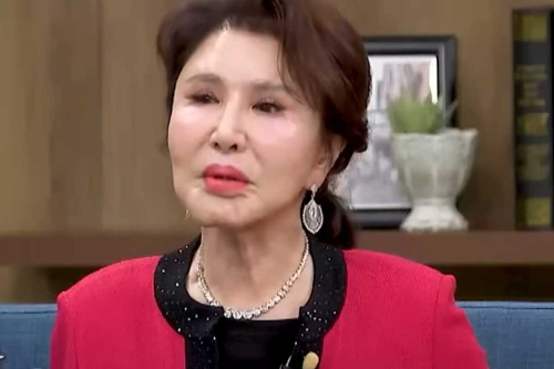 김세레나 성형 부작용