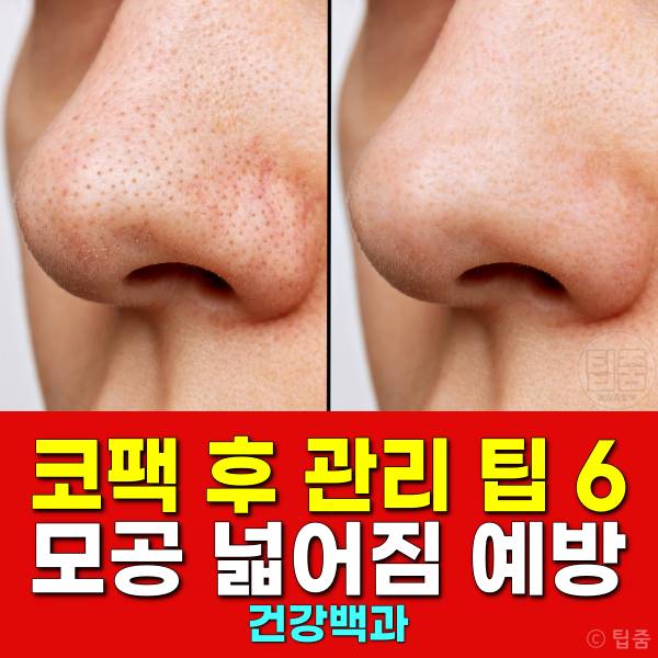 코팩 후 관리 코팩 모공 넓어짐 부작용 코팩추천
